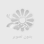 چرا بهترين راه سفيد كردن دندان با لمينت و كامپوزيت است؟